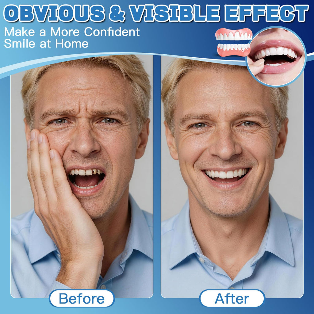 Moldable False Teeth Dentures Set with Dental Adhesive Beads S375